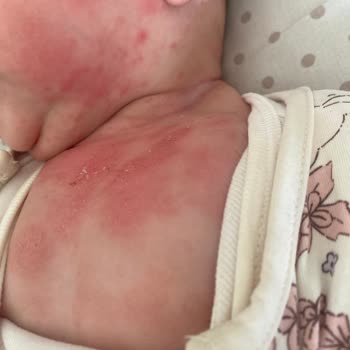 Mustela Stelatopia İntense Bebeğimi Mahvetti