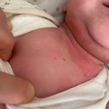 Mustela Stelatopia İntense Bebeğimi Mahvetti