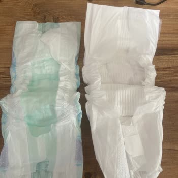 Molfix Yenilenen Bez Pişik Yaptı