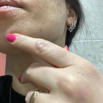 The Purest Solutions Purest Solutions C Vitamini Serum Alerjisi