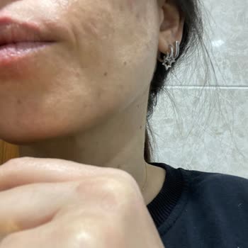 The Purest Solutions Purest Solutions C Vitamini Serum Alerjisi