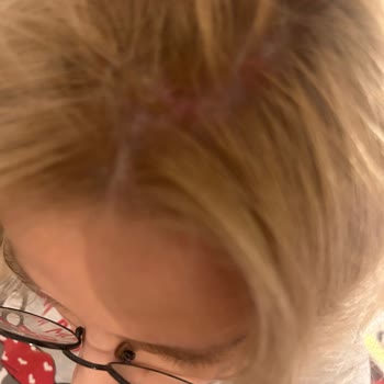 Palette Saç Dibimi Yaktı