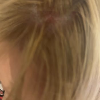 Palette Saç Dibimi Yaktı