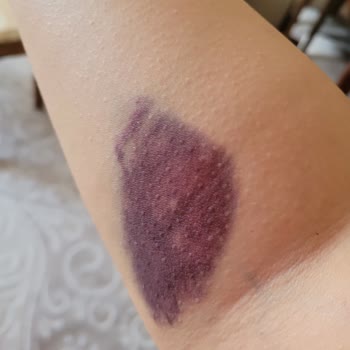 İzmir Tınaztepe Galen Bayraklı Hastanesi Hastane Ziyaretimde Yaşanan Tıbbi Rahatsızlık