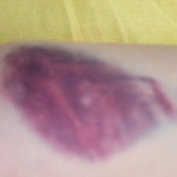 İzmir Tınaztepe Galen Bayraklı Hastanesi Hastane Ziyaretimde Yaşanan Tıbbi Rahatsızlık