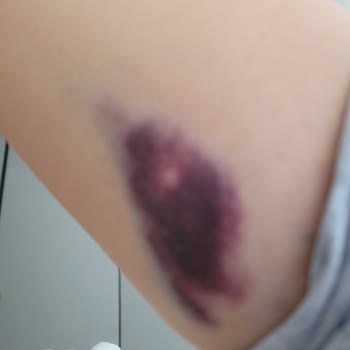 İzmir Tınaztepe Galen Bayraklı Hastanesi Hastane Ziyaretimde Yaşanan Tıbbi Rahatsızlık