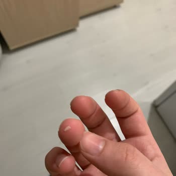 Bursa Ağız ve Diş Sağlığı Hastanesi Bursa'da Diş Çekimi Sonrası Yaşanan Sağlık Sorunları