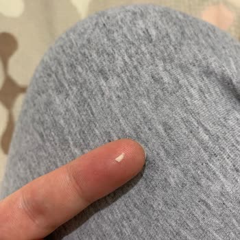 Bursa Ağız ve Diş Sağlığı Hastanesi Bursa'da Diş Çekimi Sonrası Yaşanan Sağlık Sorunları