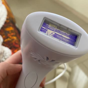 Kiwi Home Kiwi Lazer Epilasyon Cihazı Patladı