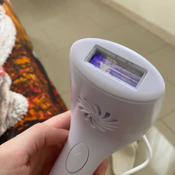 Kiwi Home Kiwi Lazer Epilasyon Cihazı Patladı