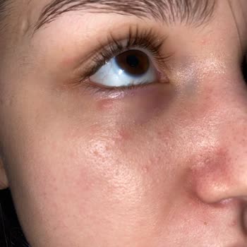 İsana Hydro Booster Göz Altı Serumu