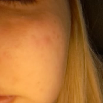 Loreal Paris Yaş Uzmanı 30+ Leke Yaptı