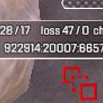 Superonline Yüksek Ping Ve Packet Loss Sorunu!