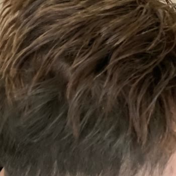 Hairlife'nin Gerçek Yüzü!