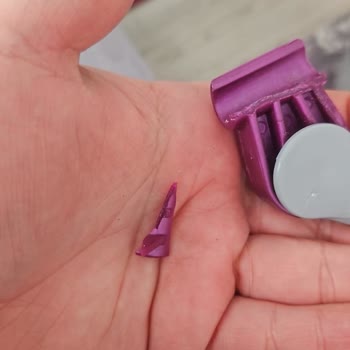 Parex'in Olumsuz Dönüşü Ve Yardımcı Olmayışı