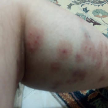 İhlas Armutlu Tatil Köyü Zehir Gibi Tatil