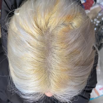 Şevval Erkin Hair & Beauty Center Saçlarımın Dipleri Koptu