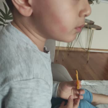 Mustela Nemlendirici Sürdükten Sonra Kızarıklık