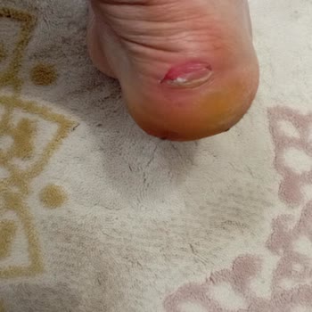 Kalitesiz Bot, Mağduriyet Ve Boyner Hüsranı