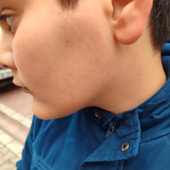 Tevfikbey Ortaokulu (İstanbul) Darp Ve Akran