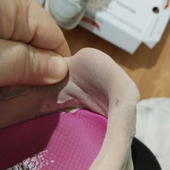 Skechers Garanti Kapsamı Neleri Kapsar Ki!