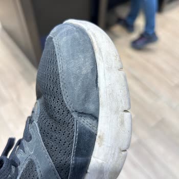 Sketchers Ayakkabı Yırtılma Problemi