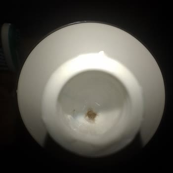 Signal Diş Macunu İçinden Çıkan Tuhaf Görüntü