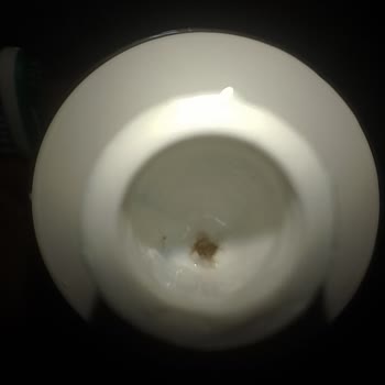 Signal Diş Macunu İçinden Çıkan Tuhaf Görüntü