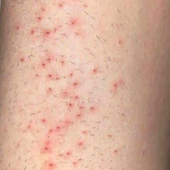 Купила средство для удаления волос Veet и пожалела