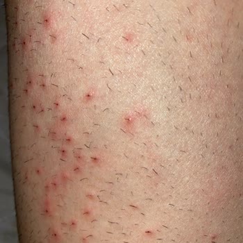 Купила средство для удаления волос Veet и пожалела