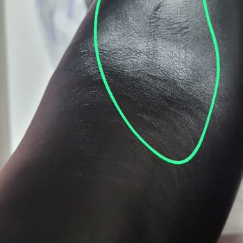 Derimod Ayakkabıya Kalıpta Hasar Verdi Değişimi Kabul Etmiyorlar