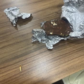 A101 Çikolatasından Diş Çıktı