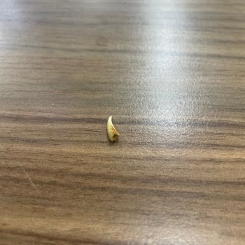 A101 Çikolatasından Diş Çıktı