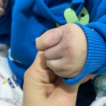 Ruha Academia Hospital Hemşirelerin İlgisizliğinden Şikayetçiyim