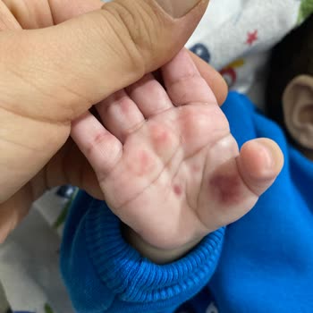 Ruha Academia Hospital Hemşirelerin İlgisizliğinden Şikayetçiyim