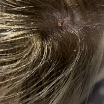 Palette 10.1 Boya Kafam Yandı