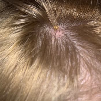 Palette 10.1 Boya Kafam Yandı