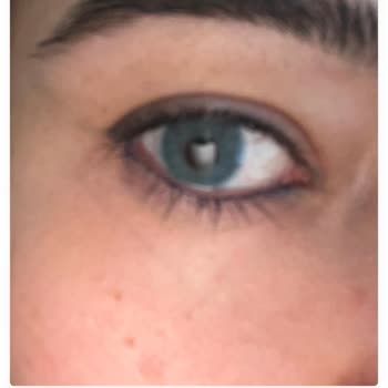 Fxeyesturkiye (Instagram) Hesabı Yanlış Lens Gönderiyor!