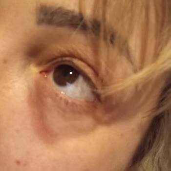 Gin Güzellik Ücretsiz Dolgu İşleminin Sonu Bu Oldu! Mağdurum.