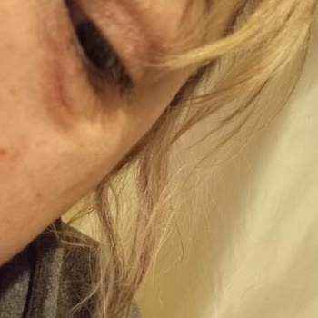 Gin Güzellik Ücretsiz Dolgu İşleminin Sonu Bu Oldu! Mağdurum.