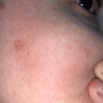 Neutrogena ŞİKAYET🥺😕LÜTFEN Görülsün Mağduriyetim Varrr❌