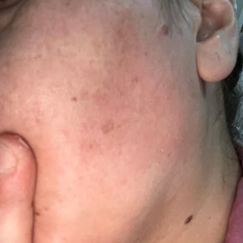 Neutrogena ŞİKAYET🥺😕LÜTFEN Görülsün Mağduriyetim Varrr❌