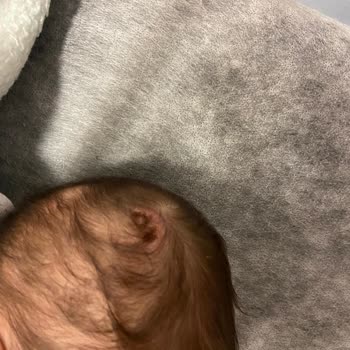 Özel Lotus Hastanesi Özel Hastanede Yaşanan Talihsiz Tedavi Süreci