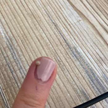 Eylül Öztürk Nail Spa Ataşehir Şubesi Manikür Hayal Kırıklığı Ve Sağlık Sorunları