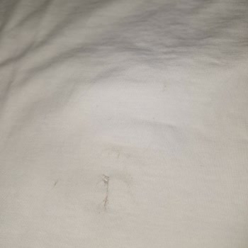 Hepsiburada Kampanya Ve Kupon Mağduriyeti