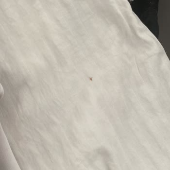 Beko Çm10120 Pas Lekesi