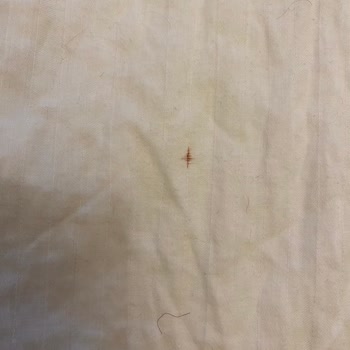 Beko Çm10120 Pas Lekesi