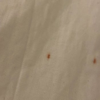Beko Çm10120 Pas Lekesi