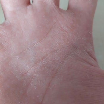 Duru Sabun Duru Okyanus Tazeliği Sıvı Sabun Kuruluk Ve Deri Dökülmesi Yaptı!