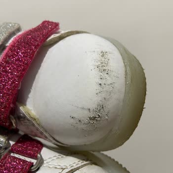 Vicco Ayakkabı Deri Soyulması Ve Çözüm Bulunmaması